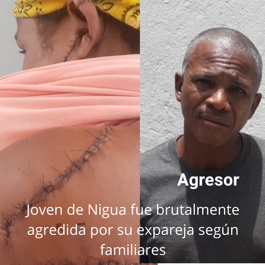 Joven de Nigua fue brutalmente agredida por su expareja según familiares